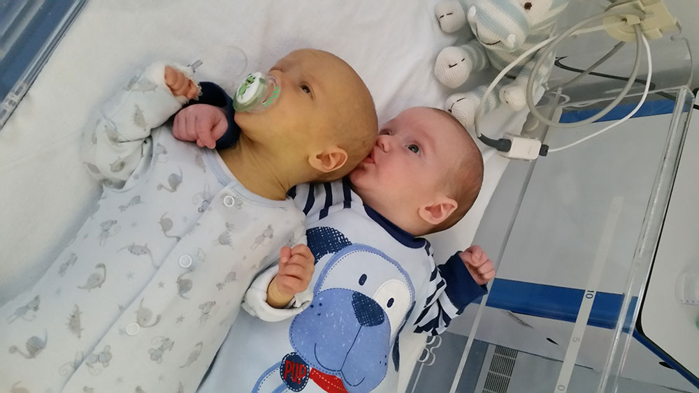 Reid-and-Eldon-jaundice-1