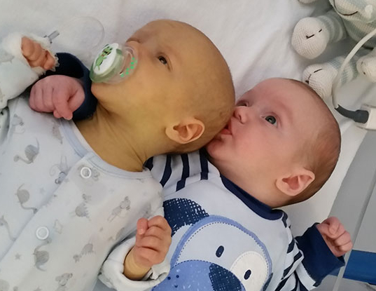 Reid-and-Eldon-jaundice-2