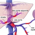 sistemaporta3