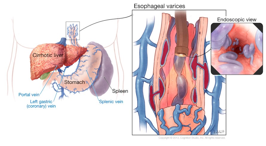 HCV-Phase1-series_r2