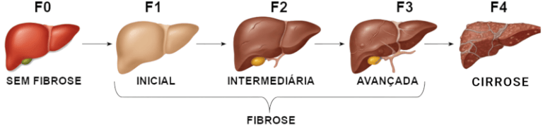 exames-laboratoriais-em-hepatologia-hepcentro